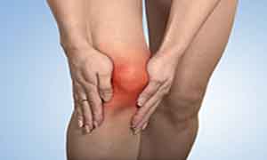 Arthroplasty Arthroplasty