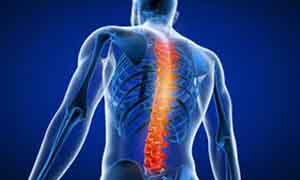 Spine Surgery Spine Surgery